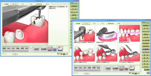 デンタルフラッシュ