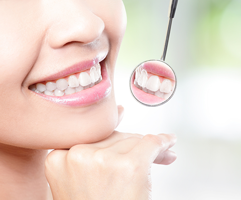 審美・ホワイトニング