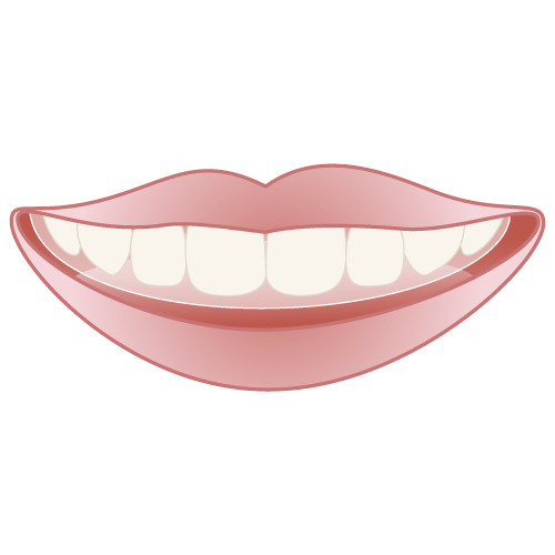 マウスピース矯正 インビザライン・シュアスマイル